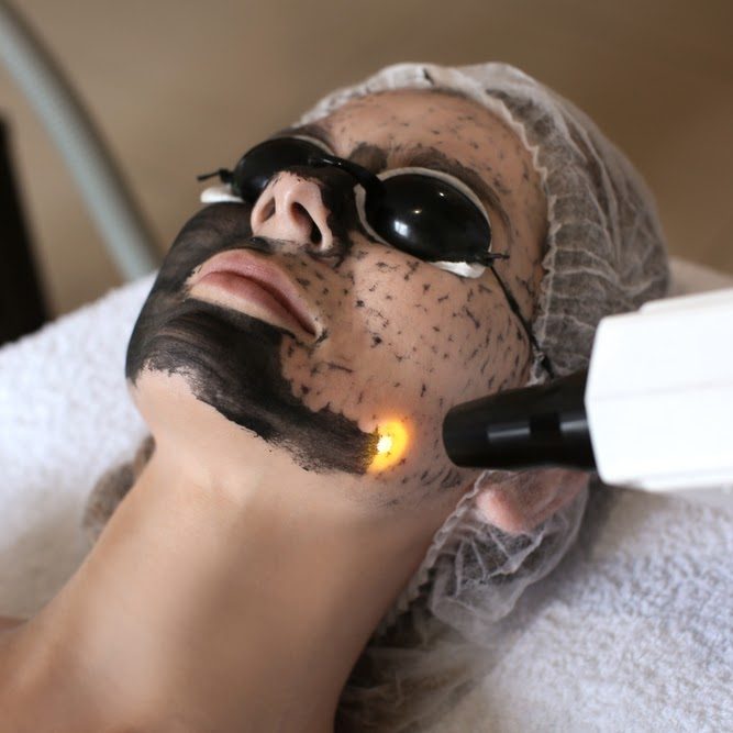Laser Toning
