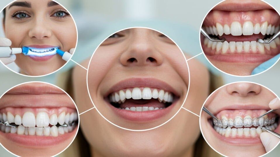 Dental Treatment