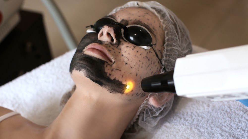 Laser Treatments