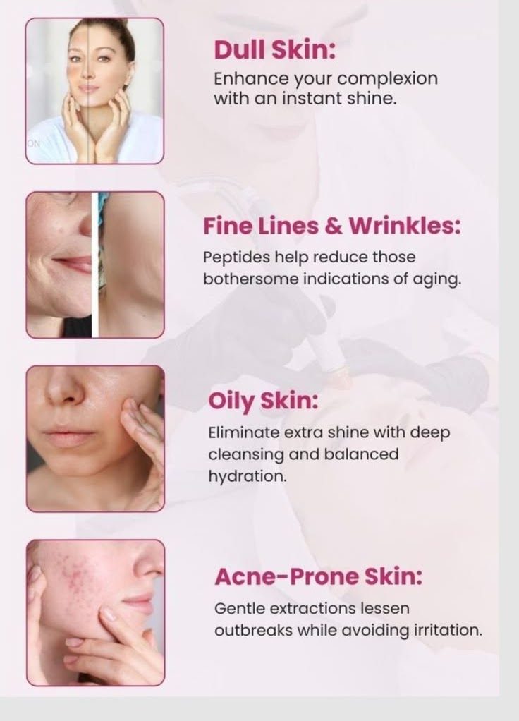 What is a HydraFacial?