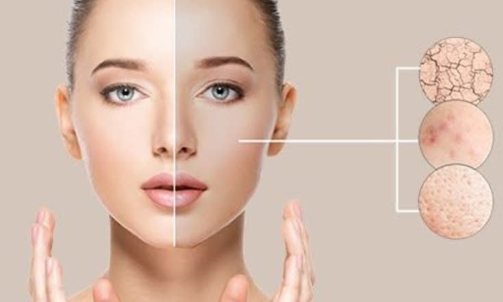Pigmentation Treatment