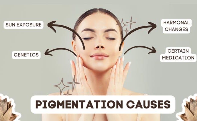 Causes of Pigmentation