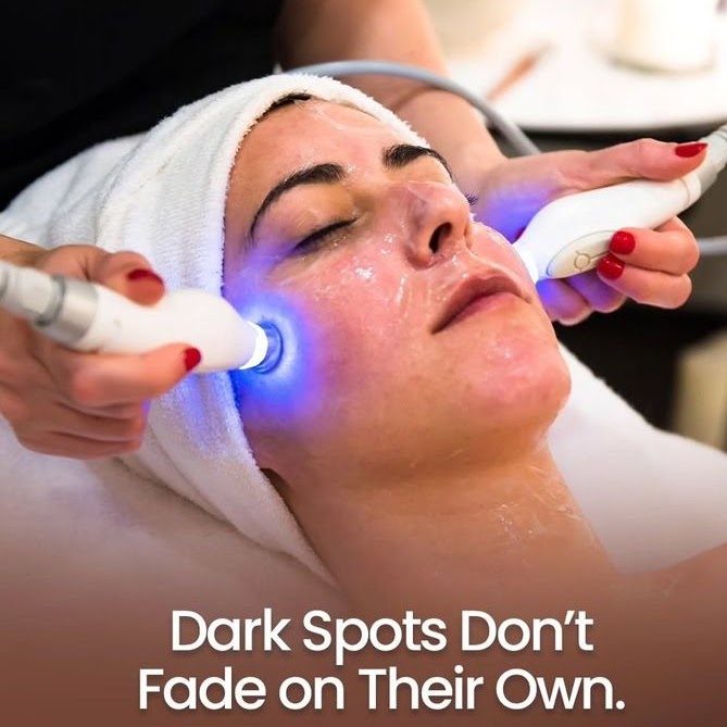 Skin Brightening Procedures
