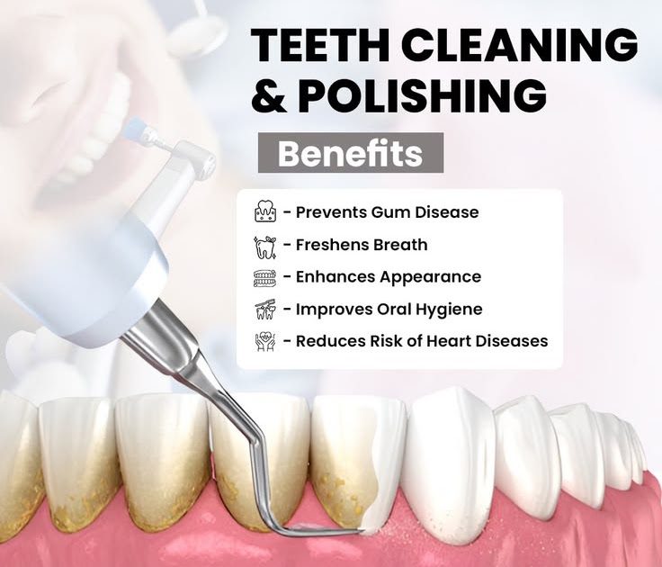How Often Should Teeth Cleaning Be Done?