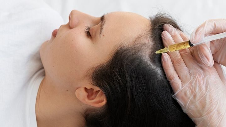 PRP Therapy