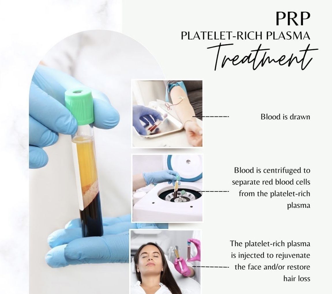 What is PRP Hair Treatment?