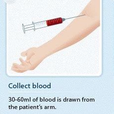 1. Blood Collection