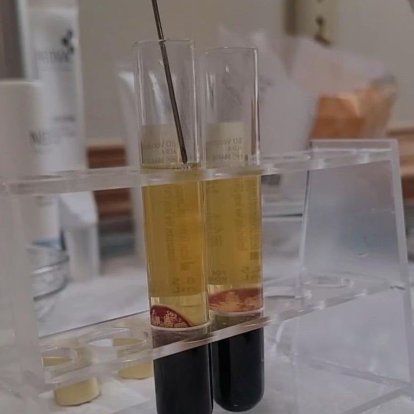 3. PRP Separation
