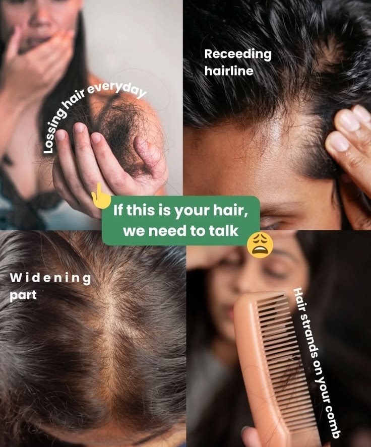 Common Signs of Hair Loss