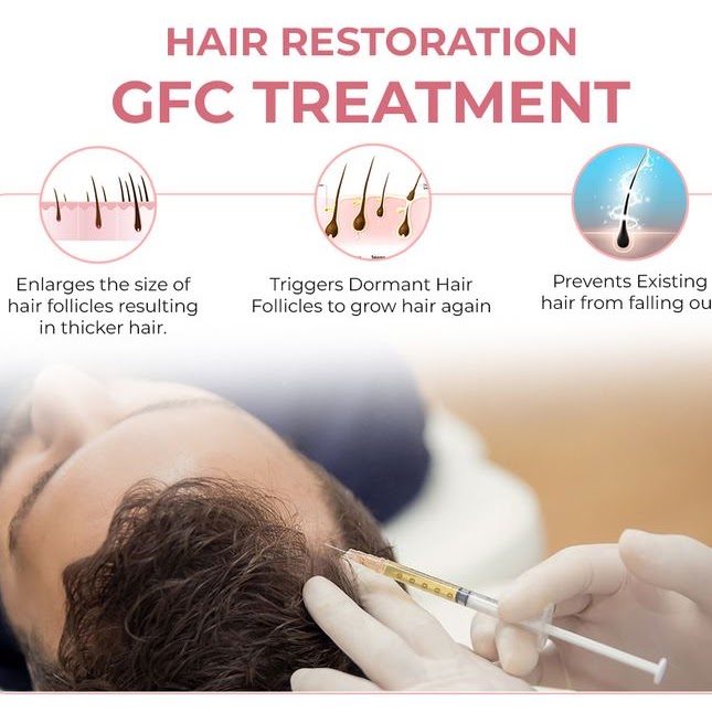 PRP Hair Treatment