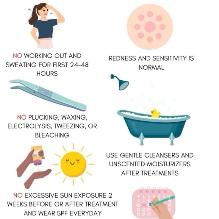 Laser Procedure