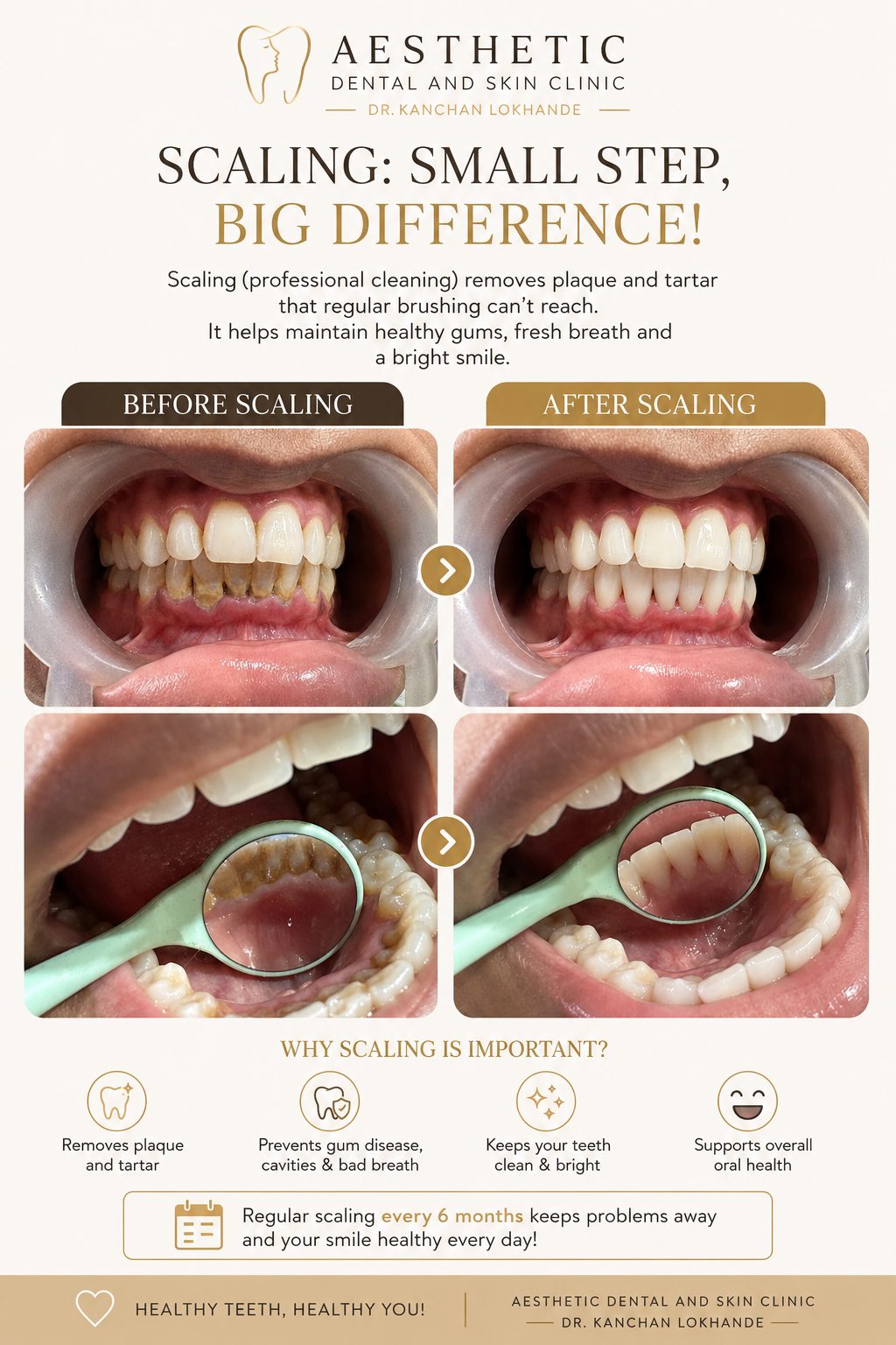 Professional Teeth Cleaning & Polishing