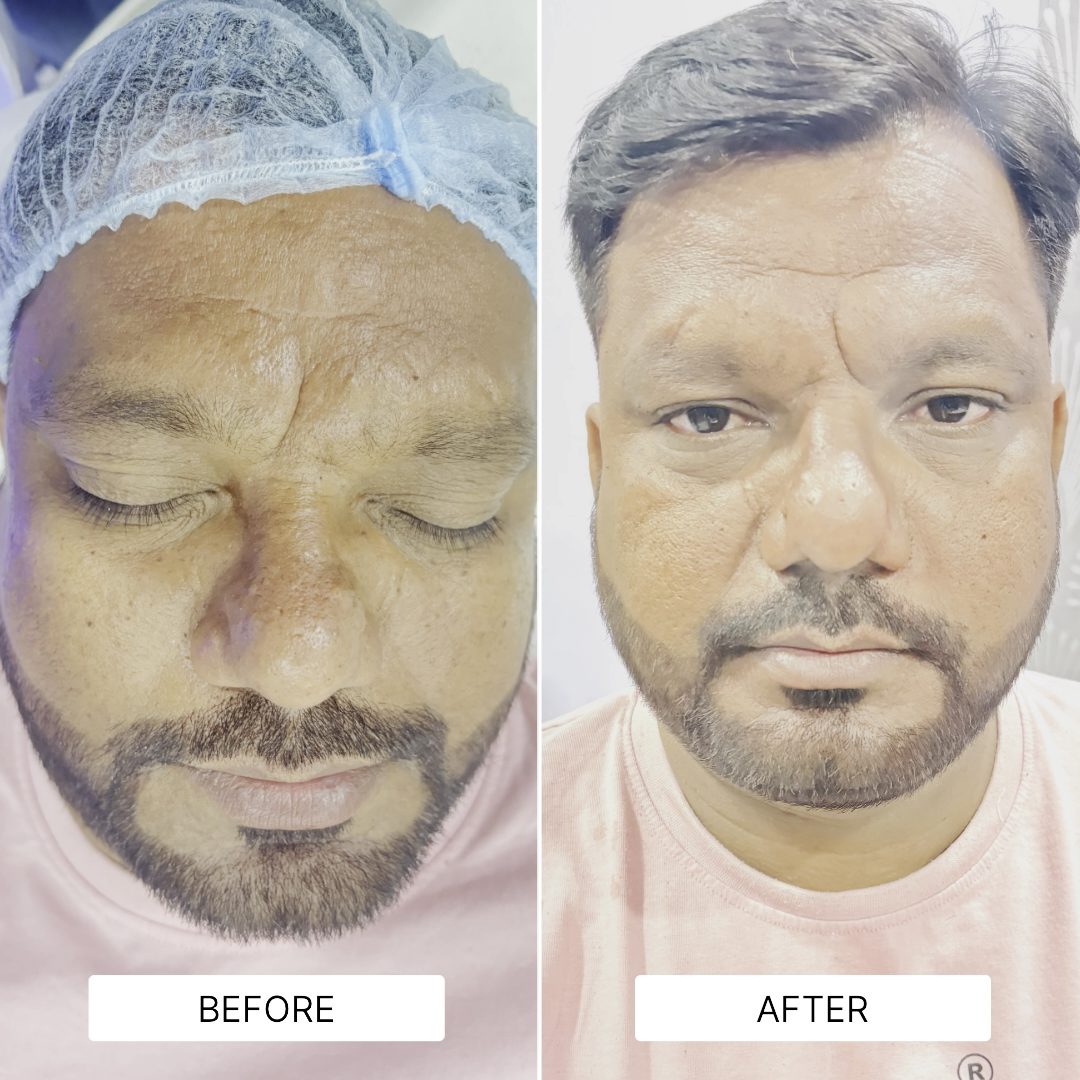 MEDIFACIAL