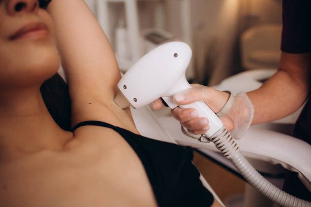 Pigmentation Laser Treatments