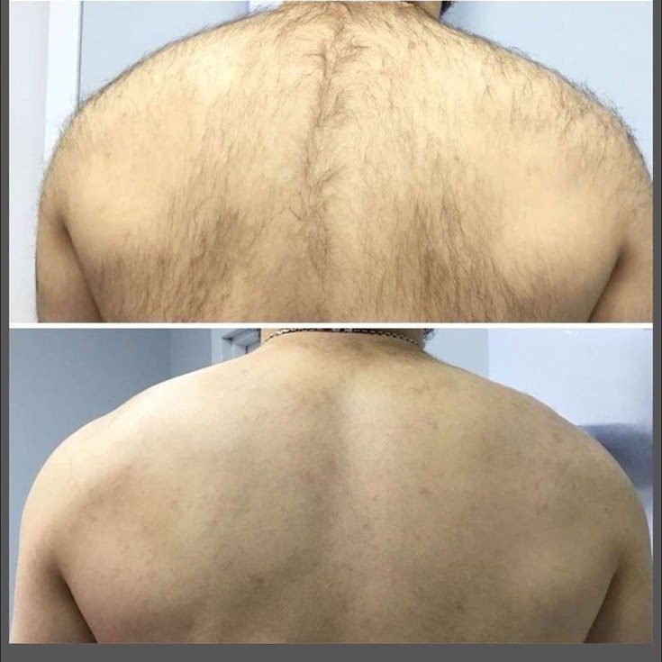 Post-Treatment Care