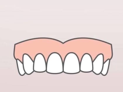 Бруксизм – непроизвольный скрип зубов, как избавиться