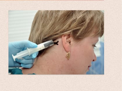 Кабинет гирудотерапии снова работает в Красноуральске