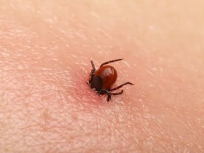 Как я скиталась по ЦГБ С клещом в плече