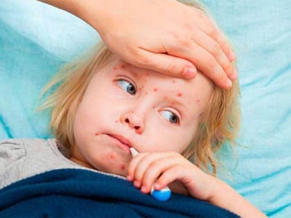 Корь – угроза сохраняется