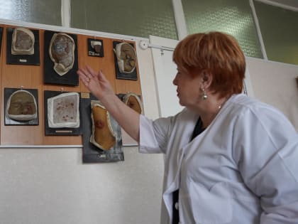 Врачи предупреждают уральцев об участившихся случаях бессимптомного течения сифилиса