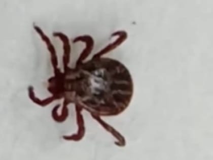 Почти семь тысяч пострадавших от укусов клещей зарегистрировано с начала сезона в Свердловской области