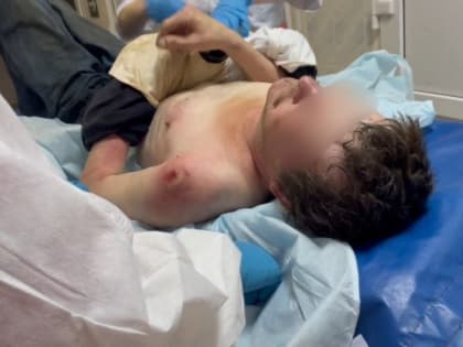 Ожоги  на теле и душе. Гниющие раны, двое суток за закрытой дверью и необъяснимые действия медиков в судьбе одного человека