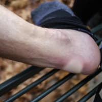 Пластирі від мозолів Lifesystems Blister Plasters – фото 4