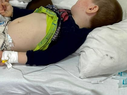 В Махачкале зарегистрирован новый очаг кори