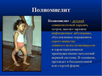 Почему важно вакцинироваться от полиомиелита?