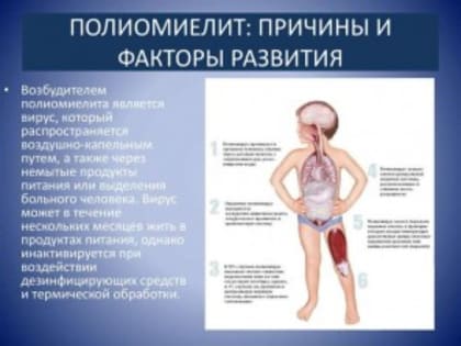 С 3 апреля в Дагестане начинается второй тур иммунизации от полиомиелита