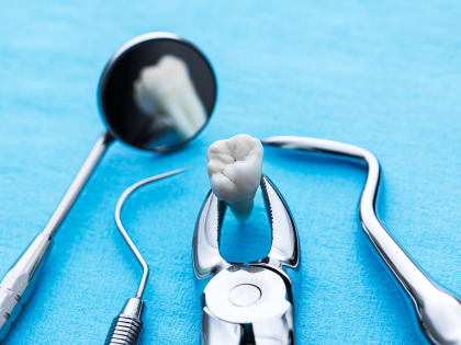 Удалили зуб: что дальше?