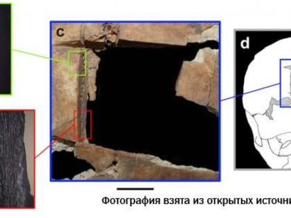 В Израиле найдено самое раннее свидетельство операции на черепе