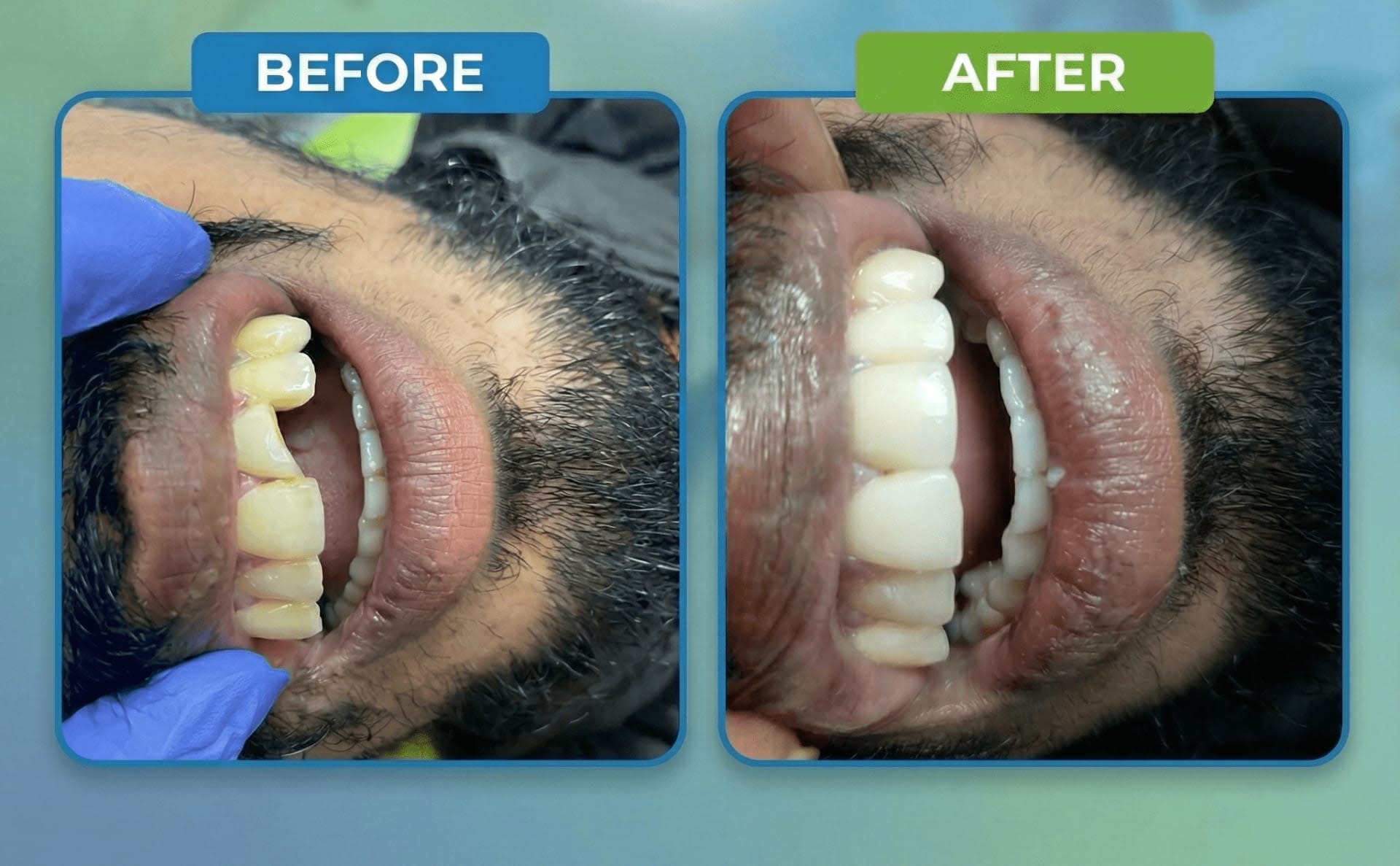 স্মাইল ডেন্টাল কেয়ার - যাত্রাবাড়ী শাখা gallery - Smile Dental Care