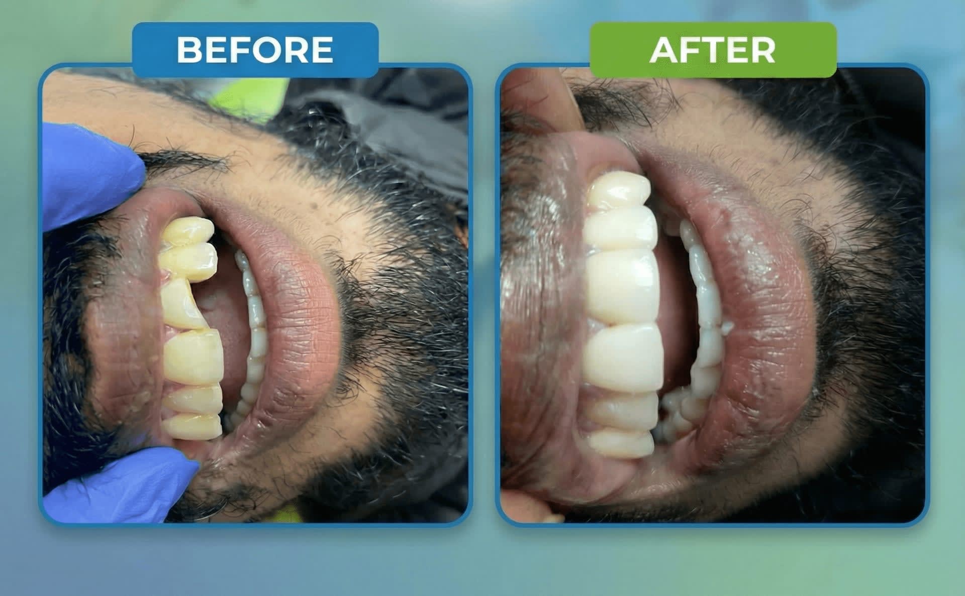 স্মাইল ডেন্টাল কেয়ার - যাত্রাবাড়ী শাখা gallery - Smile Dental Care