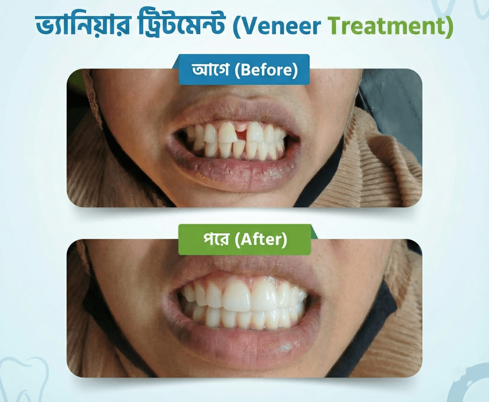 স্মাইল ডেন্টাল কেয়ার - বরিশাল শাখা gallery - Smile Dental Care