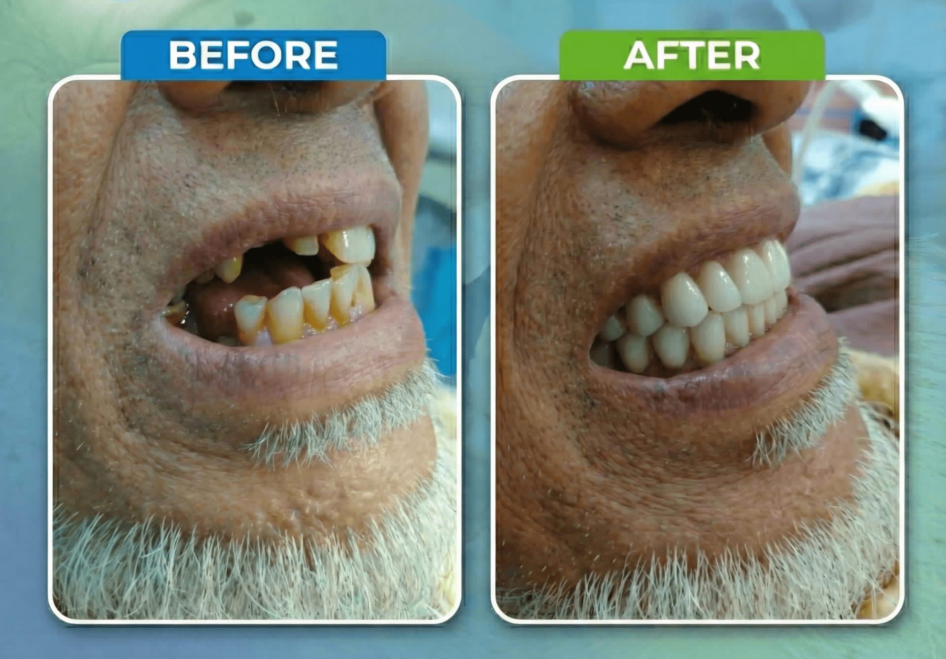 স্মাইল ডেন্টাল কেয়ার- ডৌয়াতলা, বরগুনা শাখা gallery - Smile Dental Care