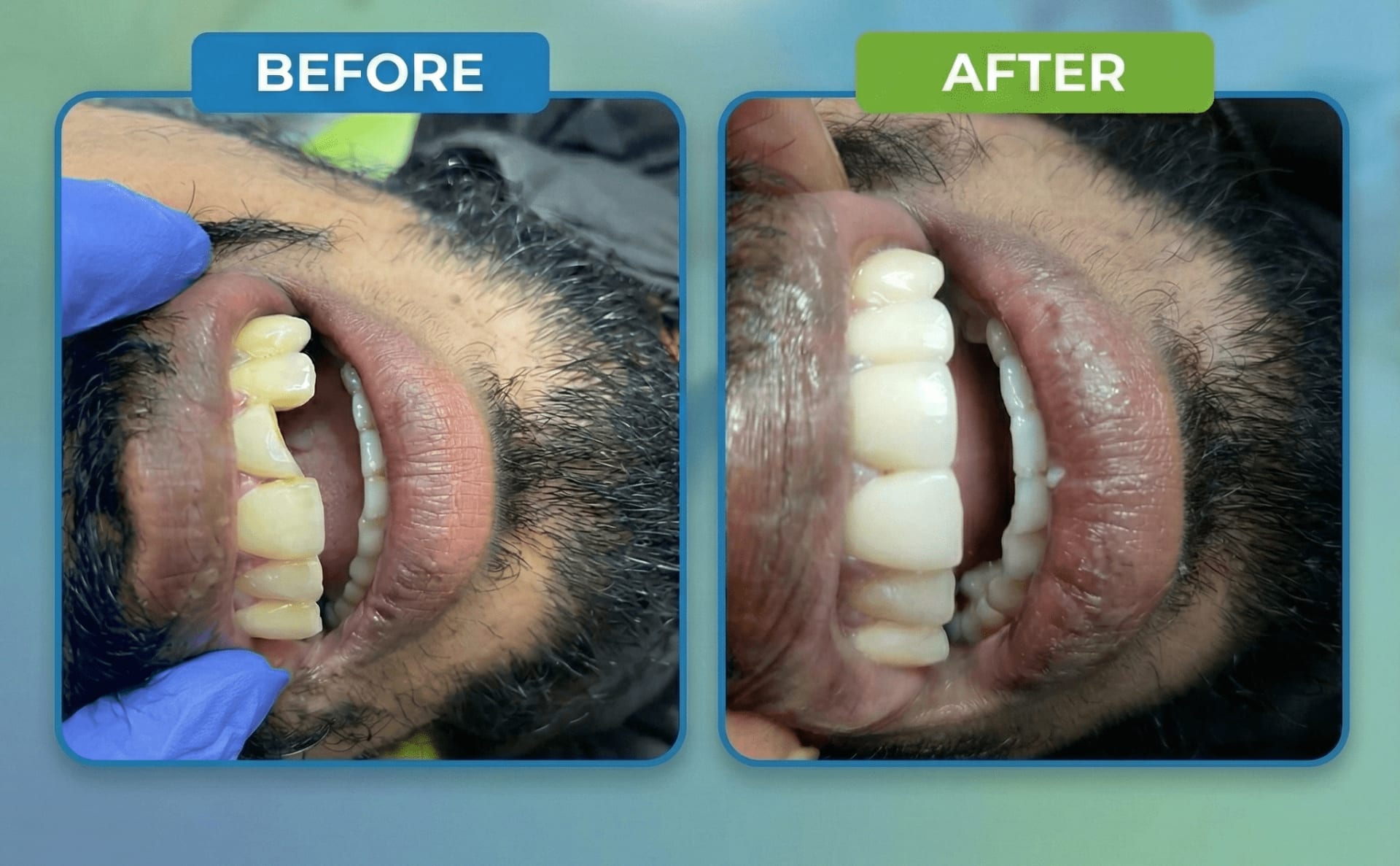 স্মাইল ডেন্টাল কেয়ার - যাত্রাবাড়ী শাখা gallery - Smile Dental Care