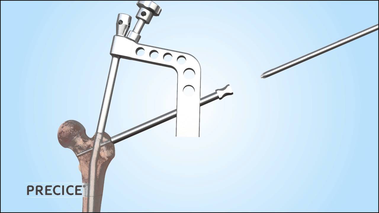 Precice 2 Video Image Holder