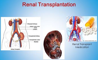 renal-transplantation