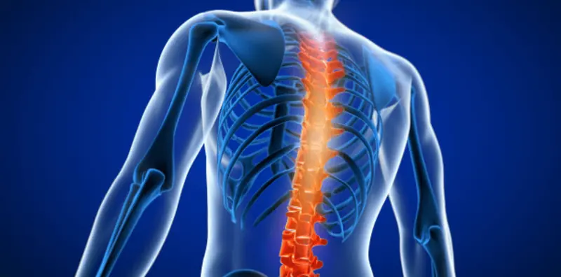 Spinal Decompression
