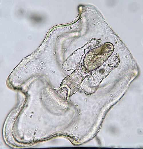 By Bruno Vellutini from São Paulo/São Sebastião, Brasil - Larva Bipinnaria, CC BY-SA 2.0, https://commons.wikimedia.org/w/index.php?curid=2891292