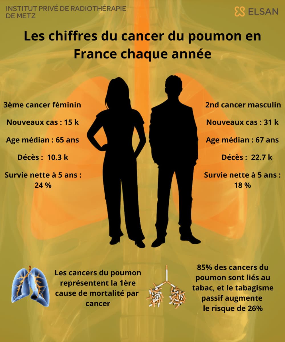esperance vie cancer poumon France