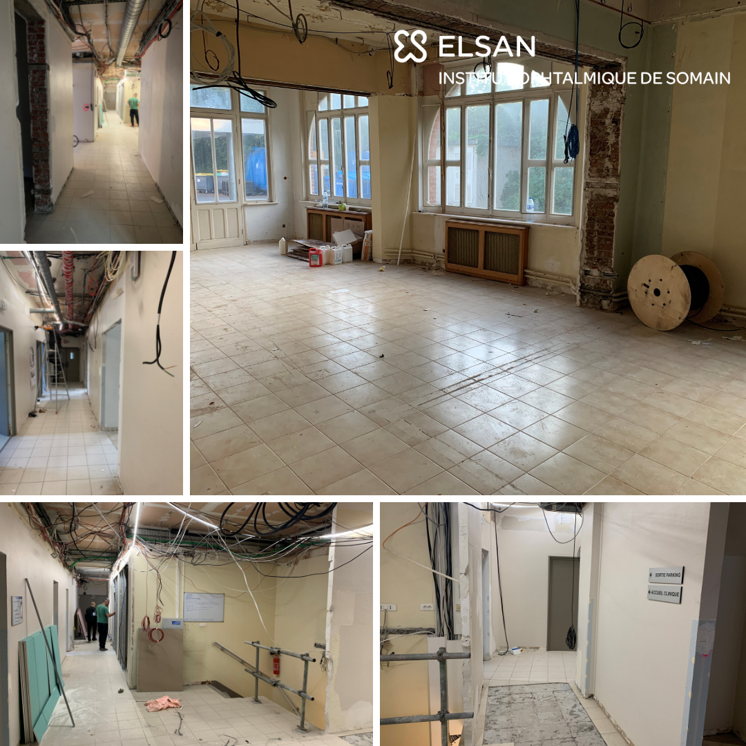 travaux ios basse vision