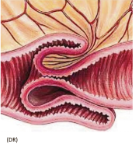 Invagination