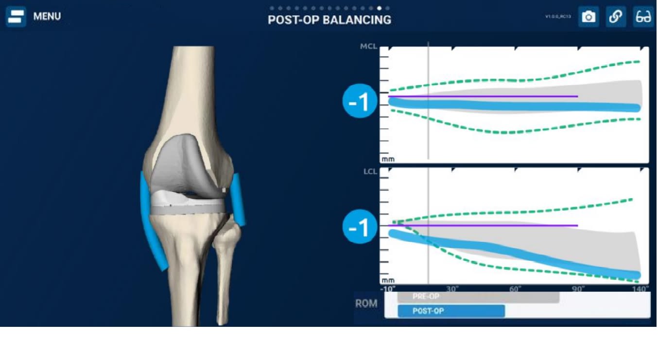 chirurgie prothétique du genou Avignon