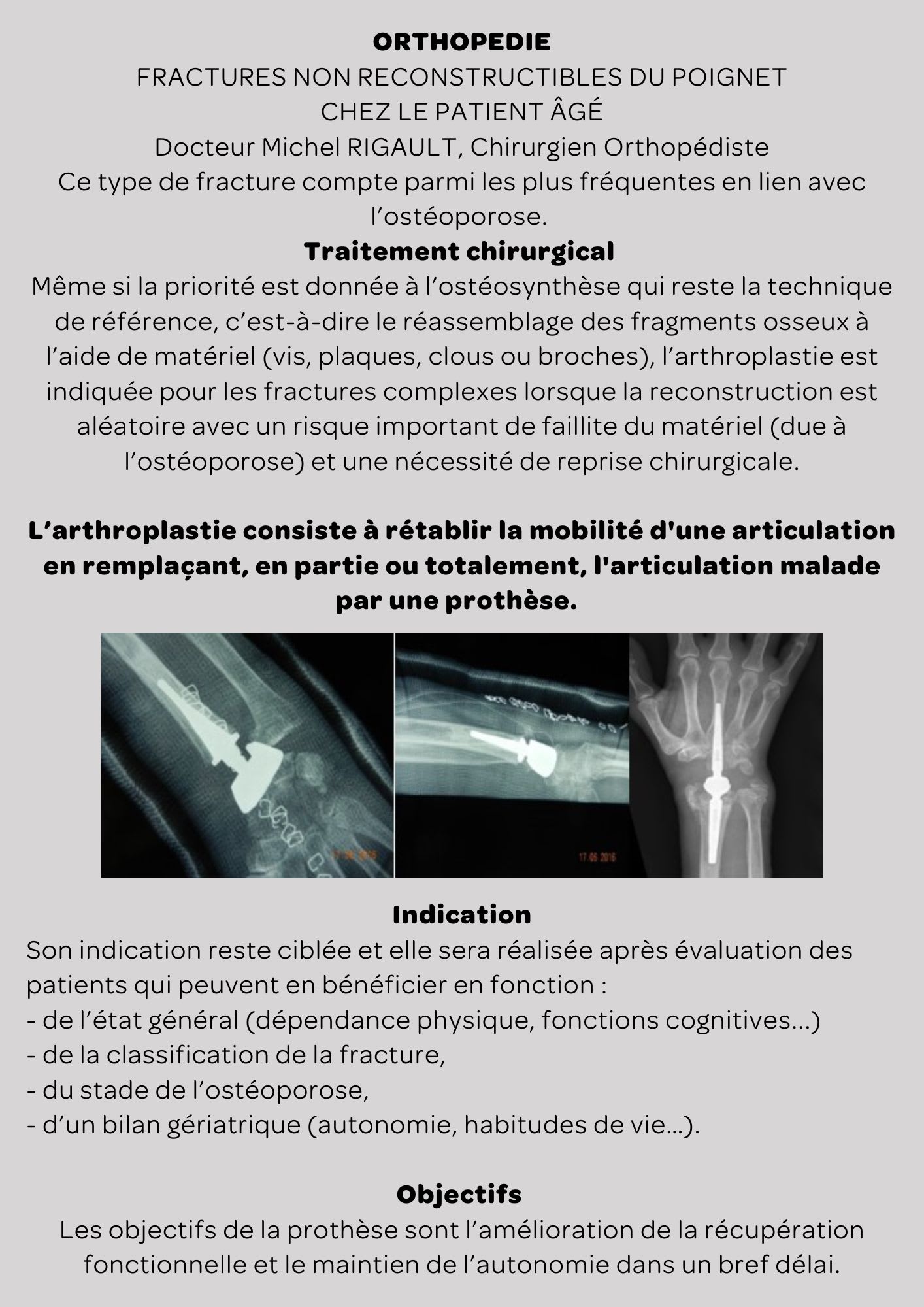 Actualités Médicales Dr Rigault probleme des fractures personnes âgées