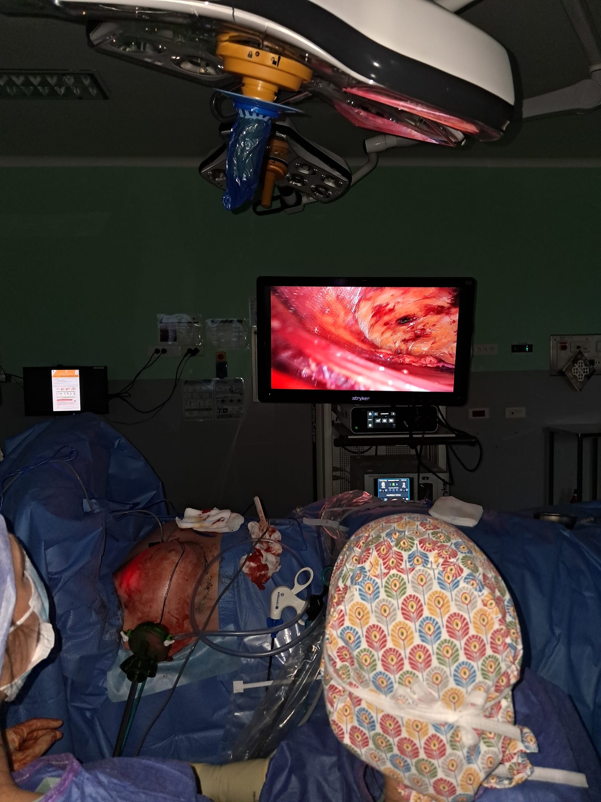 🏥 Une première à Valenciennes : la mastectomie endoscopique, une chirurgie du cancer du sein sans cicatrice apparente