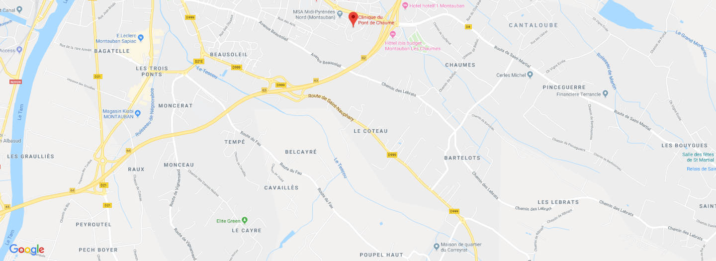 Opération de l'utérus par robot à Montauban
