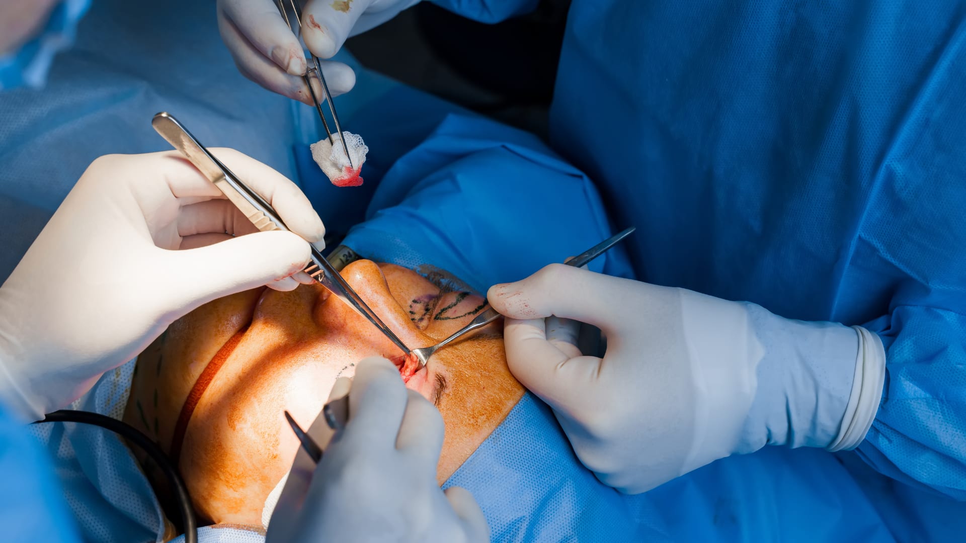 Un tout nouveau centre d’ophtalmologie pour désengorger les urgences à Marseille