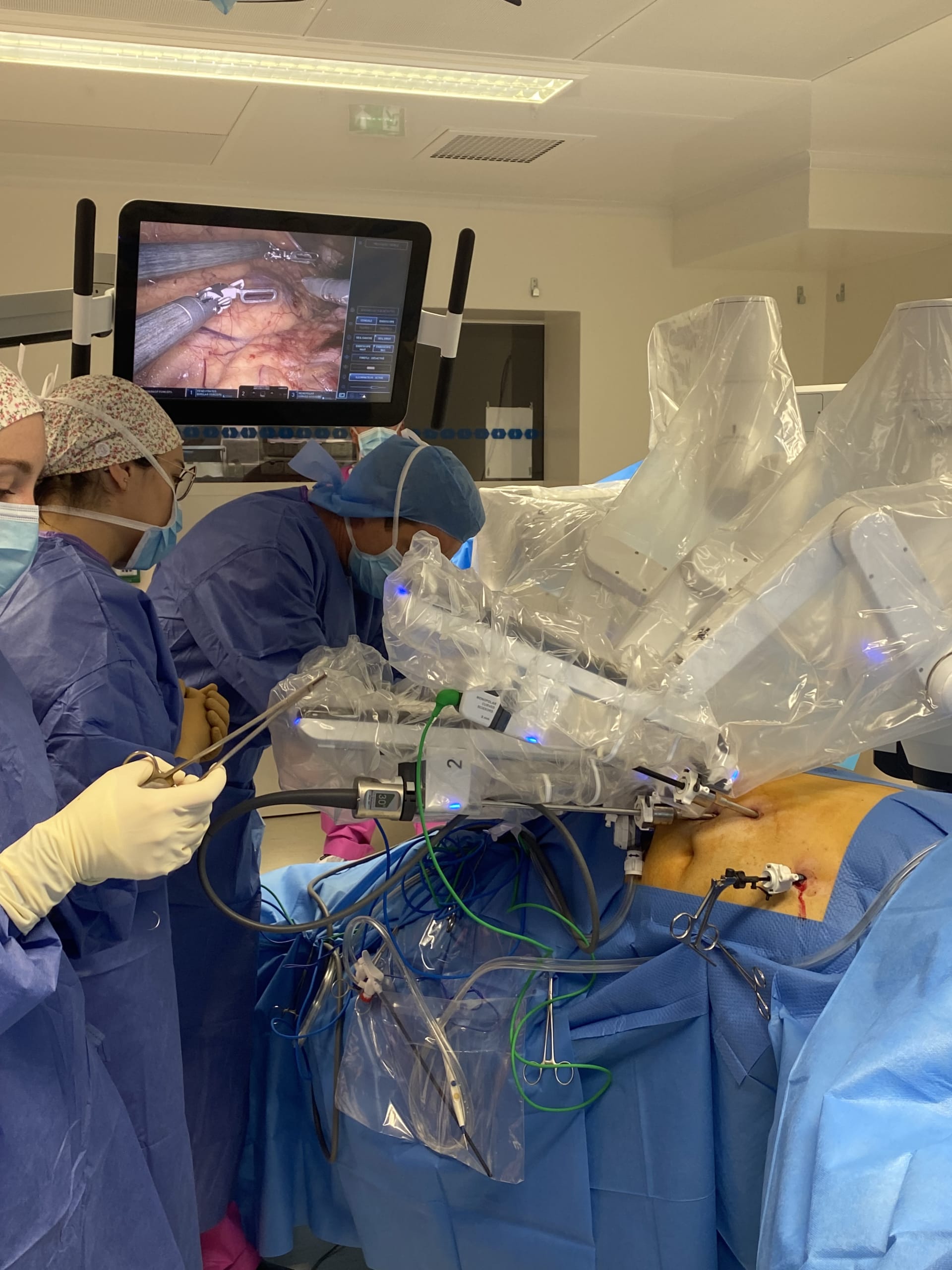 Une révolution chirurgicale s'installe à la Clinique Esquirol Saint Hilaire : la chirurgie robot-assistée